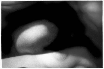 Eros 2